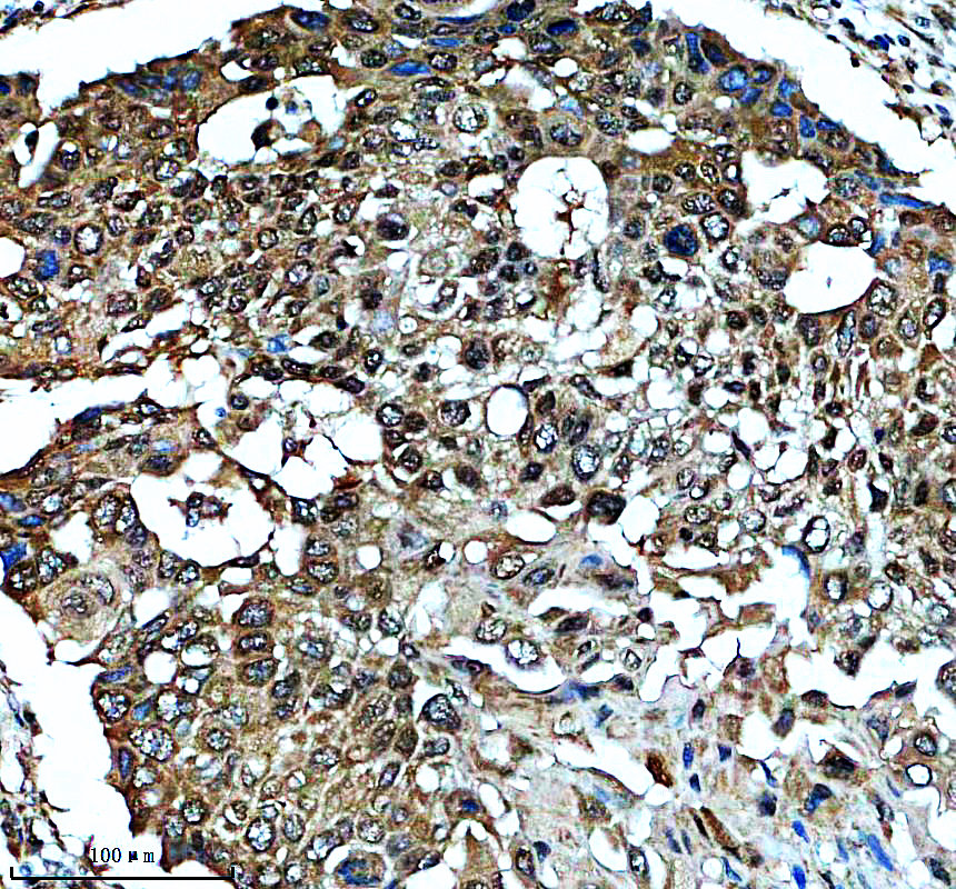IHC analysis of KBTBD7 using anti-KBTBD7 antibody (A14135)