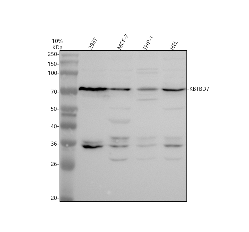 Western blot analysis of KBTBD7 using anti-KBTBD7 antibody (A14135)