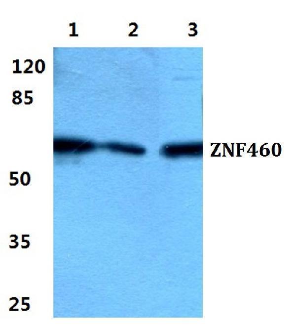 a14143 1 znf460 primary antiboties wb testing 1