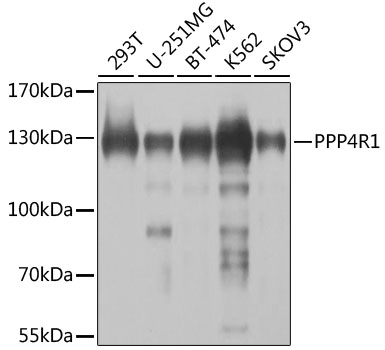 Western blot analysis of extracts of various cell lines, using PPP4R1 antibody  at 1:1000 dilution