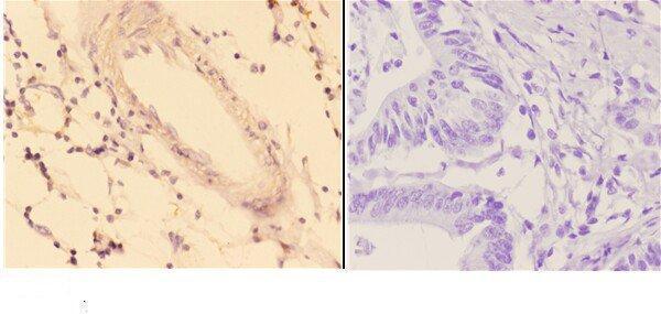 a14147 1 acot9 primary antiboties ihc testing 2