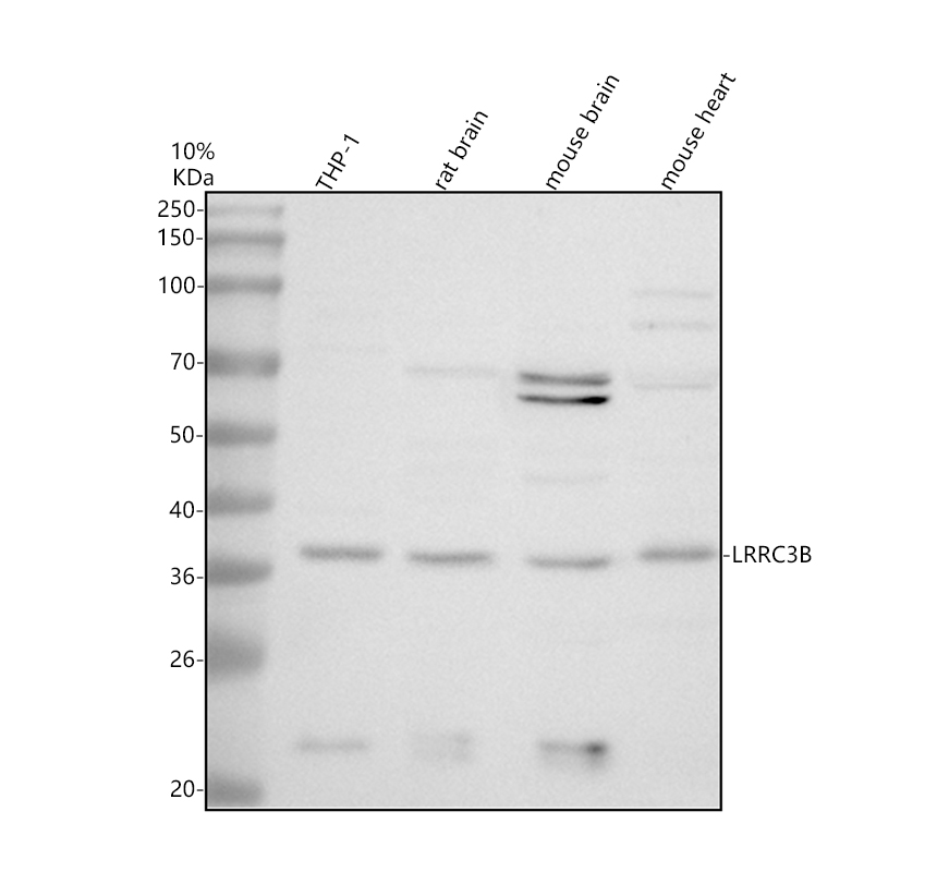 a14156 1 lrrc3b primary antibodies wb testing 1