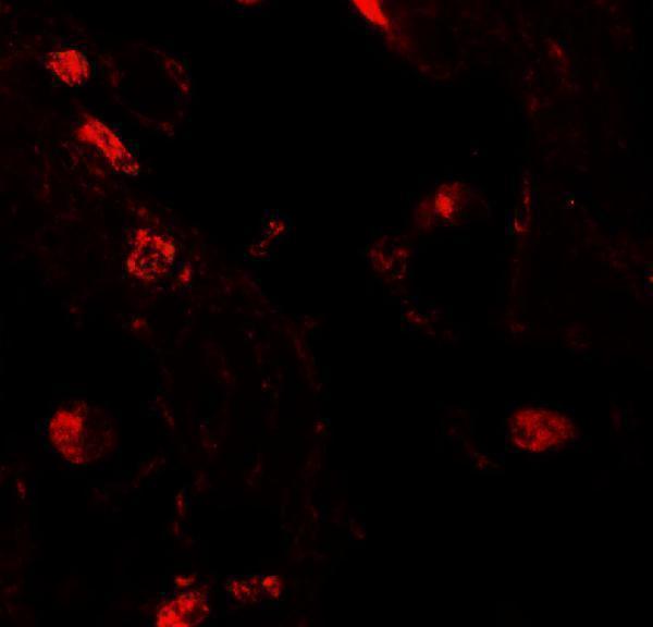 Immunofluorescence of RLP2 in human lung tissue with RLP2 antibody at 20 μg/mL