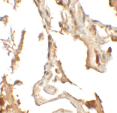 Immunohistochemistry of RLP2 in human lung tissue with RLP2 antibody at 2