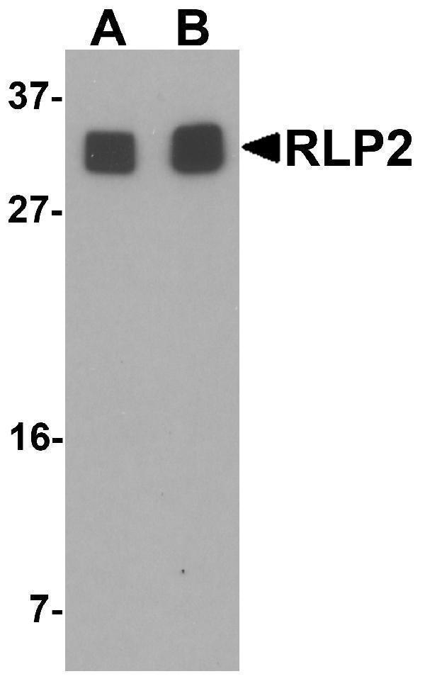 Western blot analysis of RLP2 in A549 cell lysate with RLP2 antibody at (A) 1 and (B) 2 μg/mL