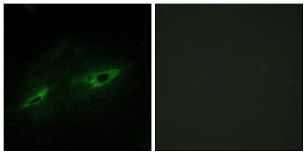 a14160 cdh22 primary antibodies if testing 1