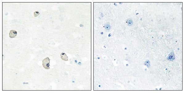 a14160 cdh22 primary antibodies ihc testing 2