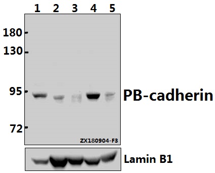 a14160t134 cdh22 primary antiboties wb testing 1