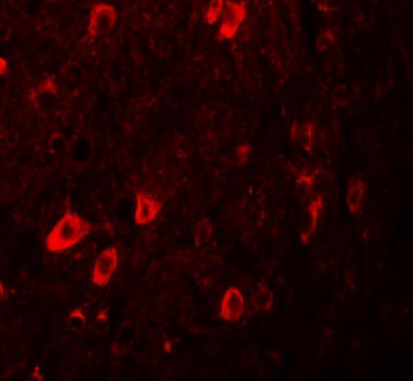 Immunofluorescence of ZBTB3 in human brain tissue with ZBTB3 antibody at 20 μg/mL