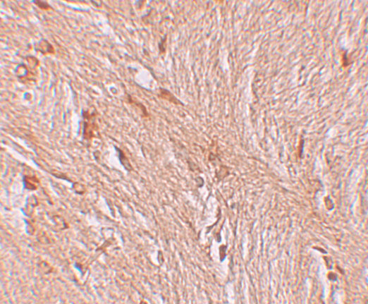 Immunohistochemistry of ZBTB3 in human brain tissue with ZBTB3 antibody at 2