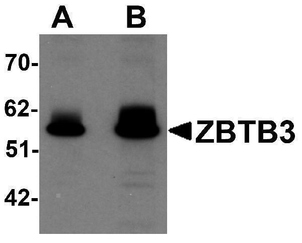 Western blot analysis of ZBTB3 in rat brain tissue lysate with ZBTB3 antibody at (A) 1 and (B) 2 μg/mL