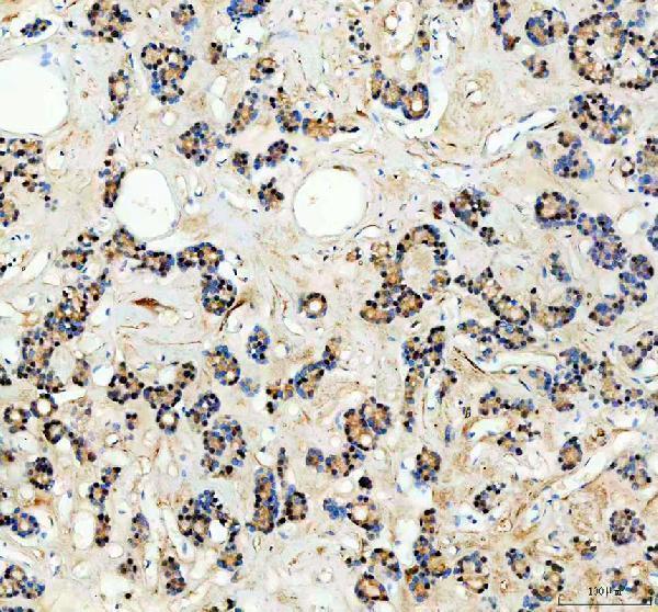 a14169 1 spopl primary antibodies ihc testing 2
