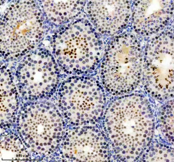 a14170 1 ubr7 primary antibodies ihc testing 1