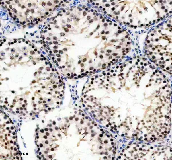 a14170 1 ubr7 primary antibodies ihc testing 2