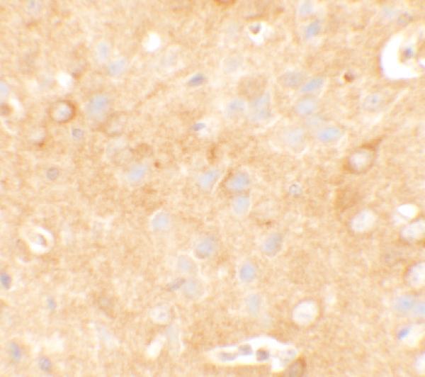a14172 1 kcnk12 primary antibodies ihc testing 2