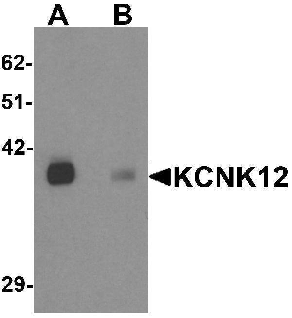 a14172 1 kcnk12 primary antibodies wb testing 1