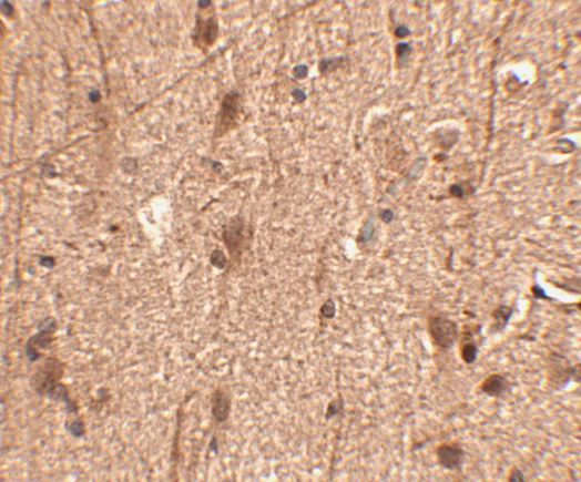 Immunohistochemistry of Slitrk3 in human brain tissue with Slitrk3 antibody at 2