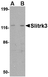 Western blot analysis of Slitrk3 in SK-N-SH cell lysate with Slitrk3 antibody at (A) 0