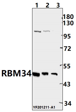 Western blot (WB) analysis of RBM34 pAb at 1:500 dilution
Lane1:PC12 whole cell lysate(40ug)
Lane2:Raw264