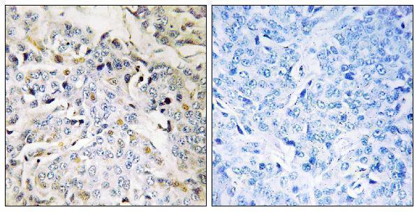 a14178 rbm34 primary antibodies ihc testing 1