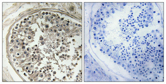 Immunohistochemistry validation of MRPS5 using Anti-MRP-S5 Antibody (A14183S5)