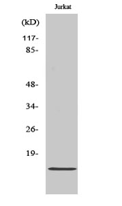 Western blotting validation for Anti-Cdc42 effector protein 5 Cdc42EP5 Antibody A14184-1
Western Blot (WB) analysis of specific cells using Cdc42EP5 polyclonal antibody