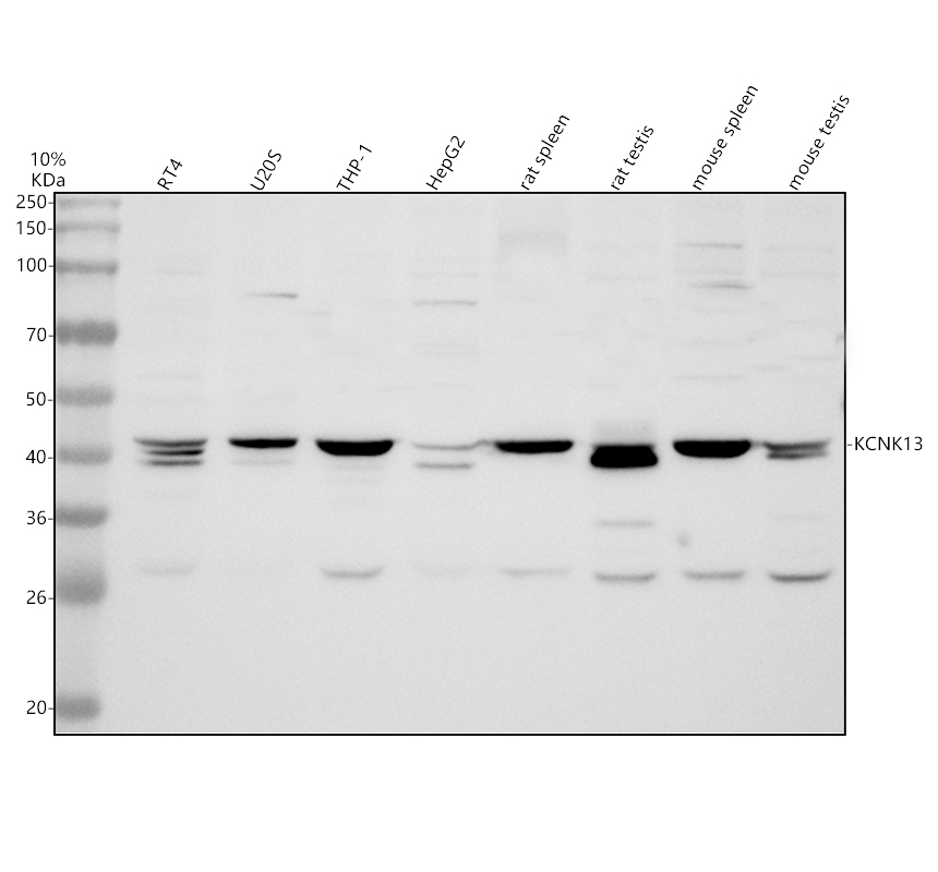 Western blot analysis of KCNK13 using anti-KCNK13 antibody (A14190-1)
