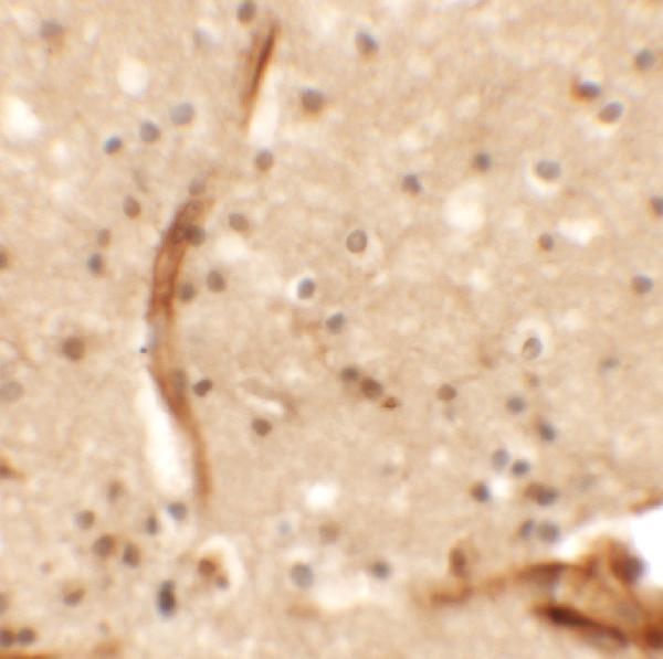 a14190 kcnk13 primary antibodies ihc testing 2