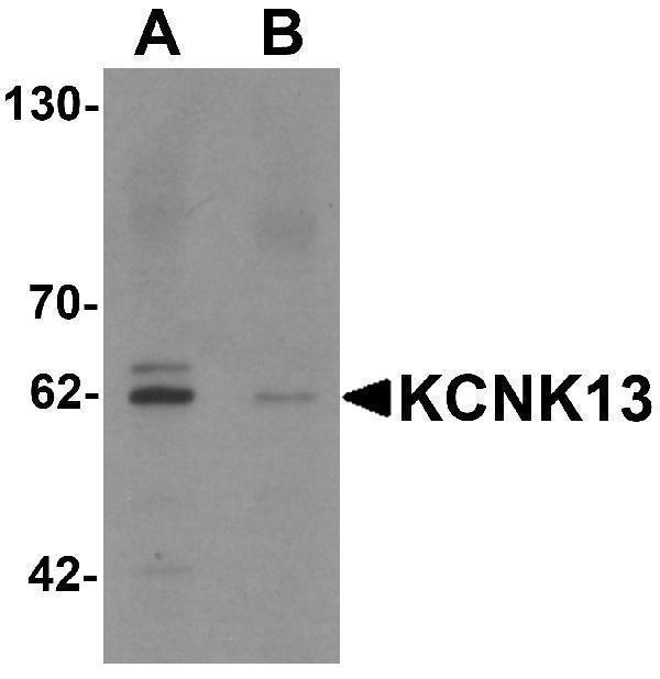 a14190 kcnk13 primary antibodies wb testing 1