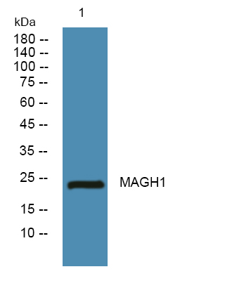 Western blot analysis of lysates from SW480 cells, primary antibody was diluted at 1:1000, 4°over night