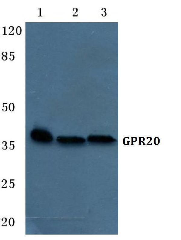 a14205 1 gpr20 primary antiboties wb testing 1