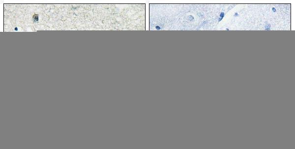 a14205 gpr20 primary antibodies ihc testing 2