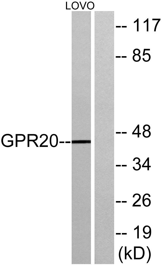 a14205 gpr20 primary antibodies wb testing 3