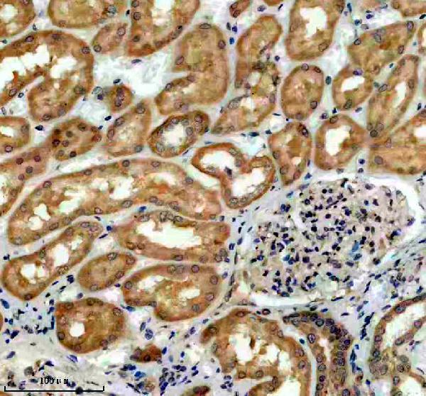 IHC analysis of TRUB1 using anti-TRUB1 antibody (A14207-1)