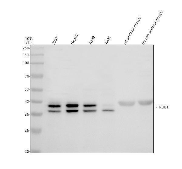 Western blot analysis of TRUB1 using anti-TRUB1 antibody (A14207-1)