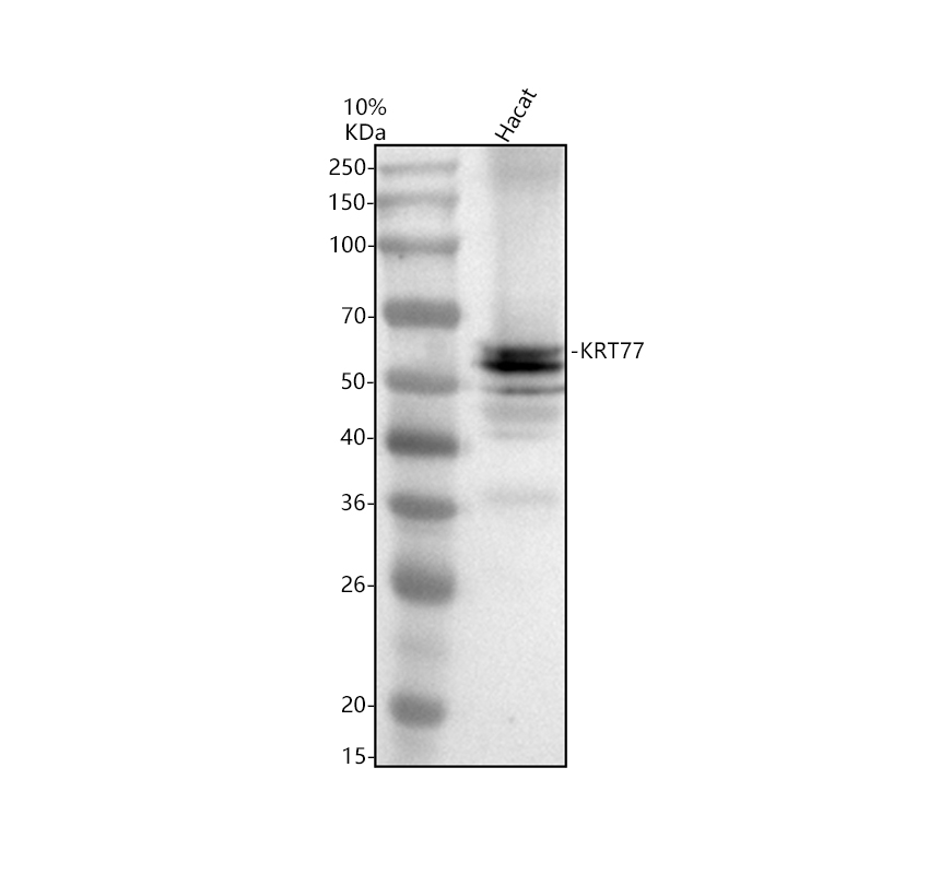Western blot analysis of KRT77 using anti-KRT77 antibody (A14209-1)