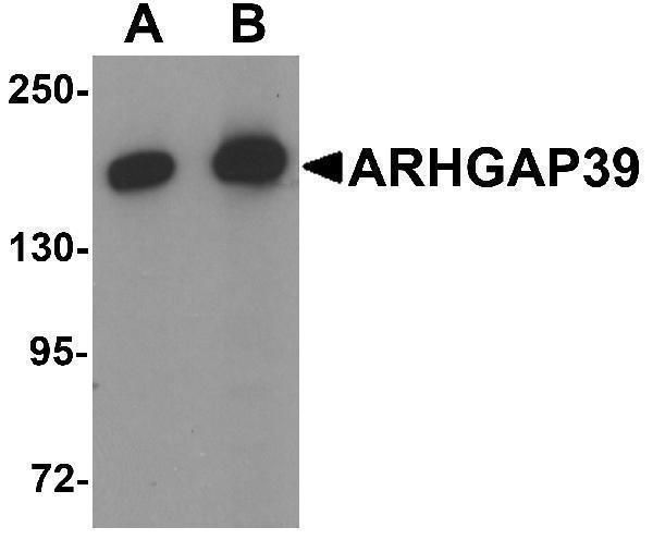 Western blot analysis of ARHGAP39 in A20 cell lysate with ARHGAP39 antibody at (A) 1 and (B) 2 μg/mL