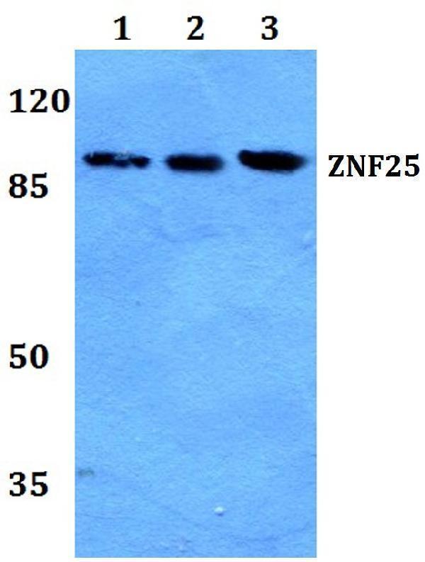 a14228 znf25 primary antiboties wb testing 1