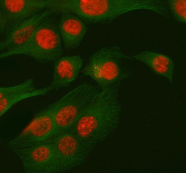 a14229 1 rbm42 primary antibodies if testing 7