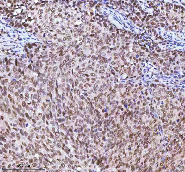  IHC analysis of RBM42 using anti-RBM42 antibody (A14229-1)