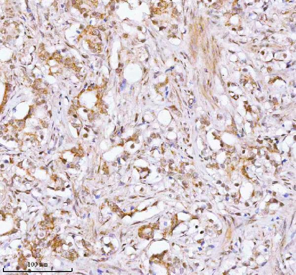  IHC analysis of RBM42 using anti-RBM42 antibody (A14229-1)
