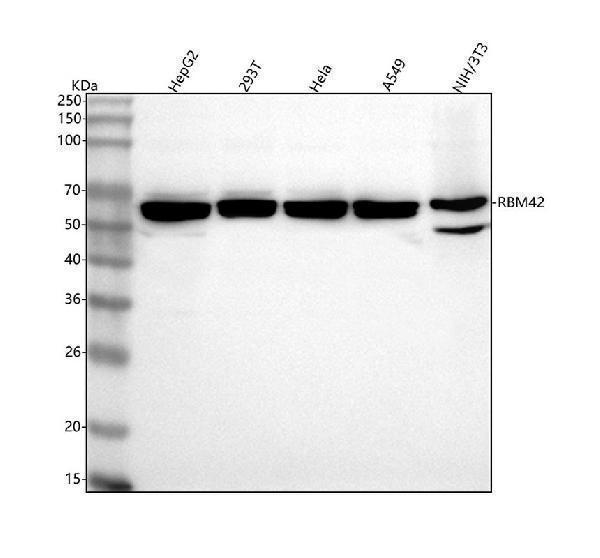  Western blot analysis of RBM42 using anti-RBM42 antibody (A14229-1)