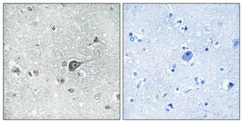 Immunohistochemical analysis of paraffin-embedded Human brain