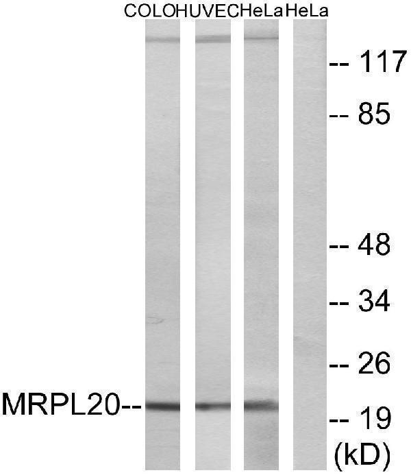Western blot analysis of lysates from Hela, HUVEC, and COLO cells, using MRPL20 Antibody