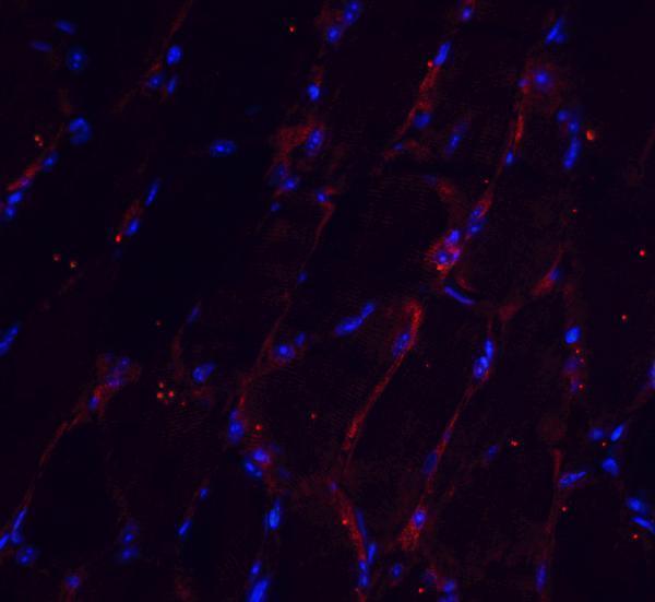 Immunofluorescence of CHADL in mouse skeletal muscle tissue with CHADL antibody at 20 μg/mL