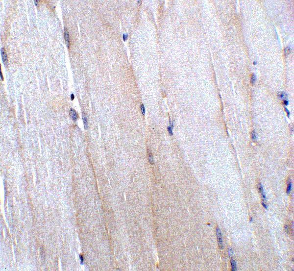 Immunohistochemistry of CHADL in mouse skeletal muscle tissue with CHADL antibody at 5 μg/mL
