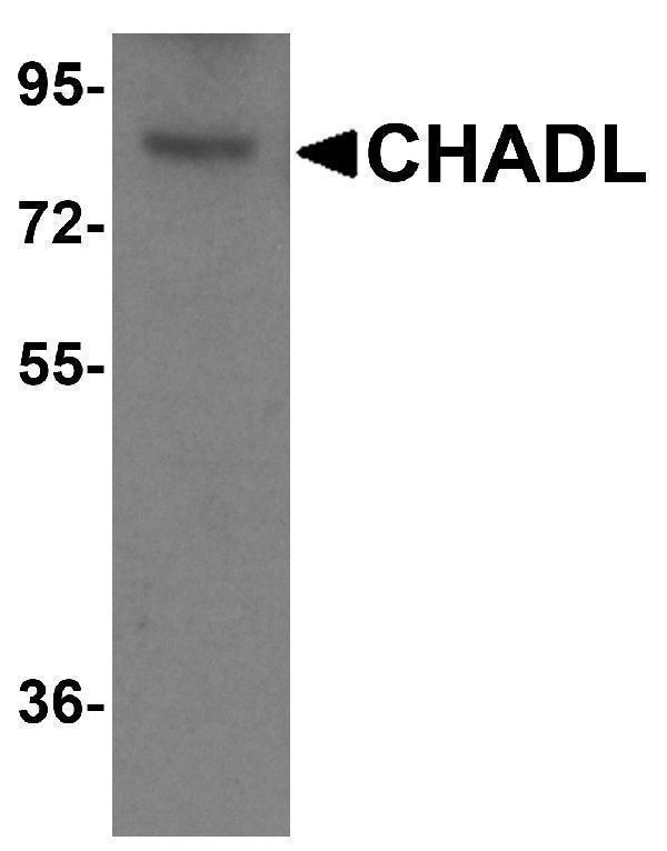 Western blot analysis of CHADL in mouse kidney tissue lysate with CHADL antibody at (A) 1 and (B) 2 μg/ml