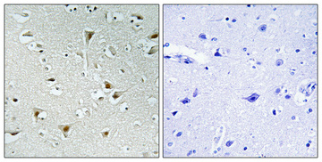 a14246 fam111b primary antibodies ihc testing 1