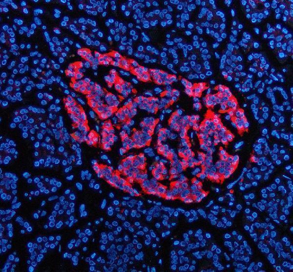 IF analysis of TRIM58 using anti-TRIM58 antibody (A14252-1)