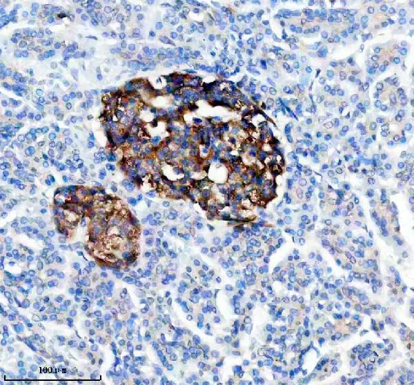 IHC analysis of TRIM58 using anti-TRIM58 antibody (A14252-1)